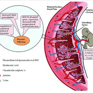Diagrammatic representation of the placental malaria and implications