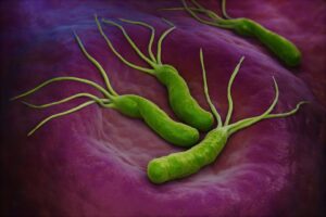 Read more about the article Helicobacter pylori infection: Whom should we test, who should we treat?