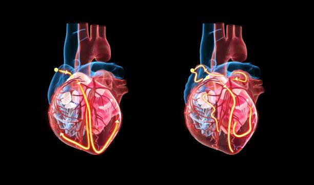 Read more about the article Atrial fibrillation. You might want to check your heart.
