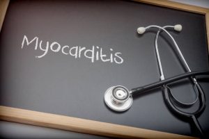 Read more about the article Myocarditis. How do you manage it?